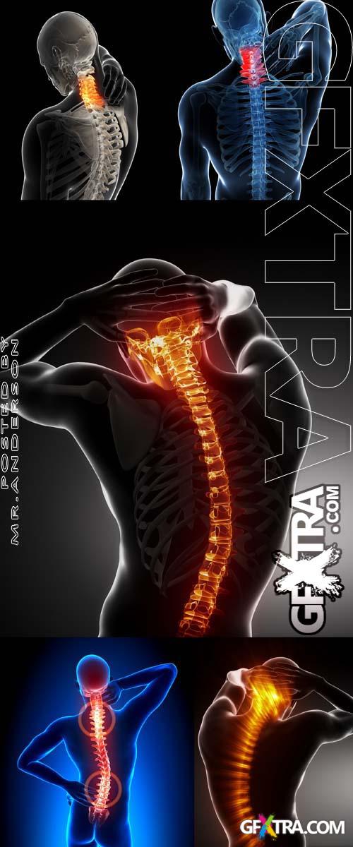 5 HQ Images Back Pain