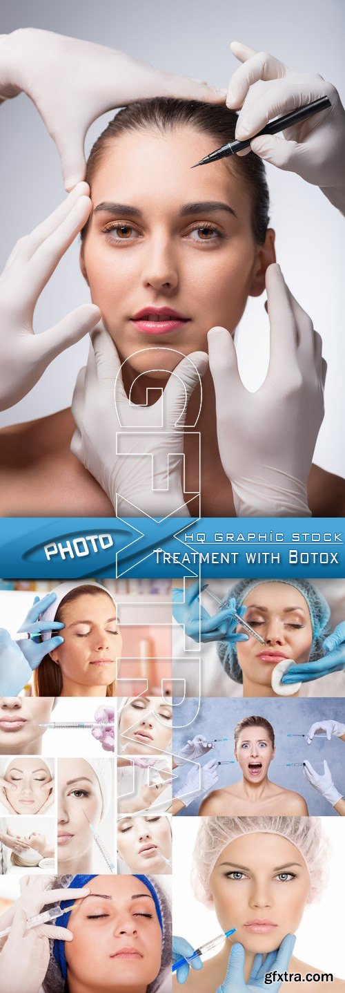 Stock photo - Treatment with Botox